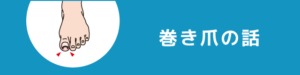 巻き爪の話